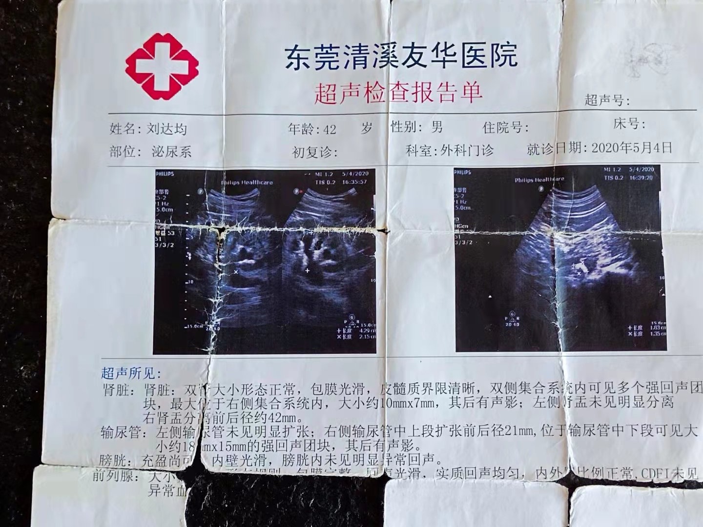 案例