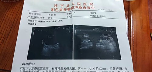 案例