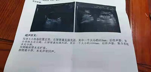 案例