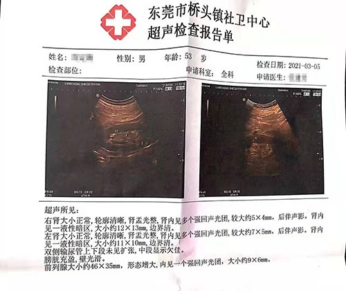 案例