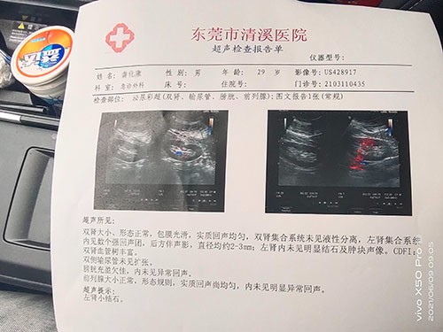 案例